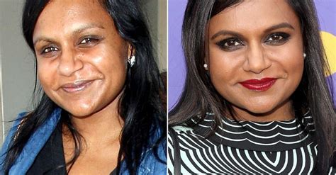 mindy kaling plastic surgery|Mindy Kaling Plastic Surgery: Transformation Photos, Quotes